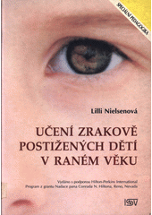 Učení zrakově postižených dětí v raném věku  Cover Image