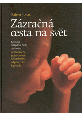 Zázračná cesta na svět : kronika 38 týdnů cesty do života s jedinečnými fotografiemi od početí až k porodu  Cover Image