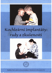 Kochleární implantáty : rady a zkušenosti  Cover Image